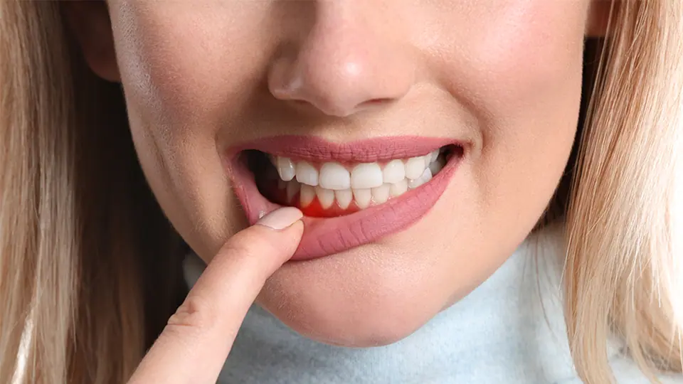 Seven Tooth Sensitivity Treatment Options