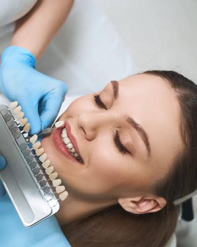 What Are Dental Veneers in Dubai