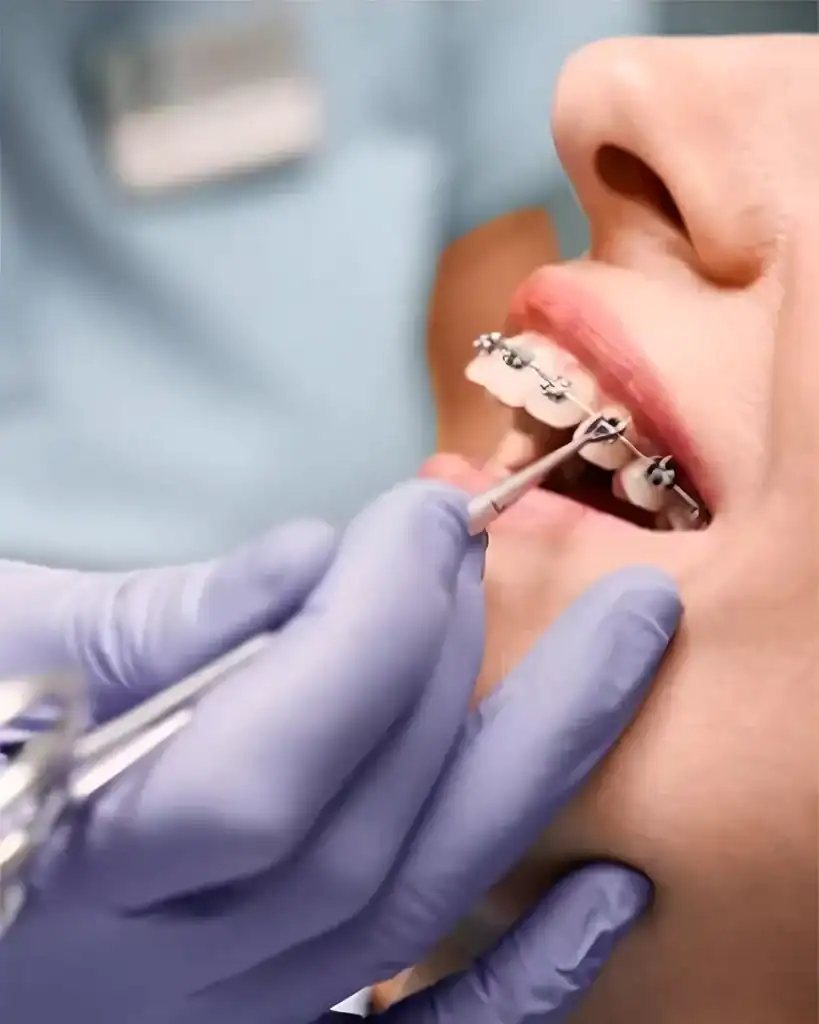 What Does an Orthodontist in Dubai Do